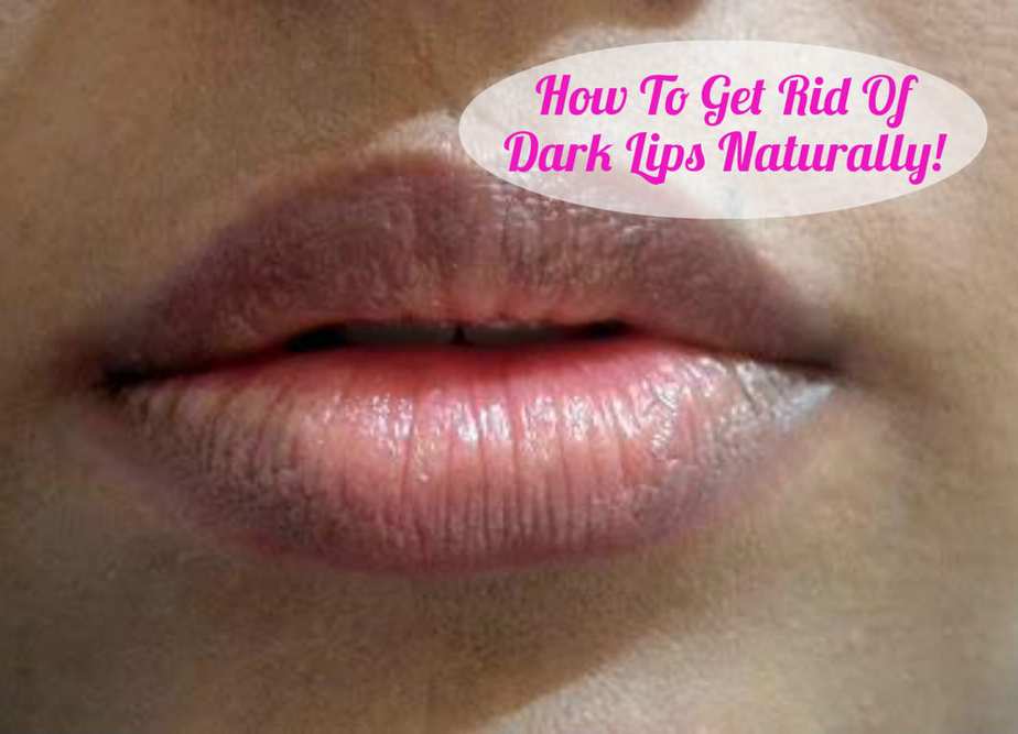 remedies for dark pigmented lips