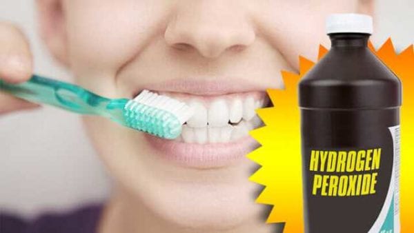 How to Whiten Teeth Overnight